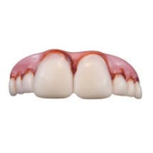 Megabucks Teeth